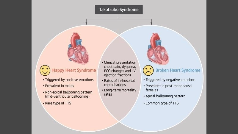 Emotional stress and heart attack link between mind and heart