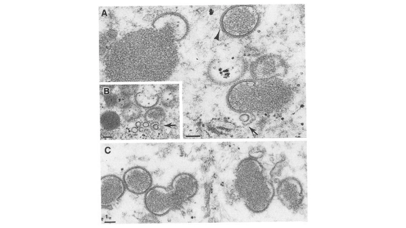 Learn about Tanapox virus and human infection