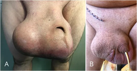 Demonstration of a testicular self exam