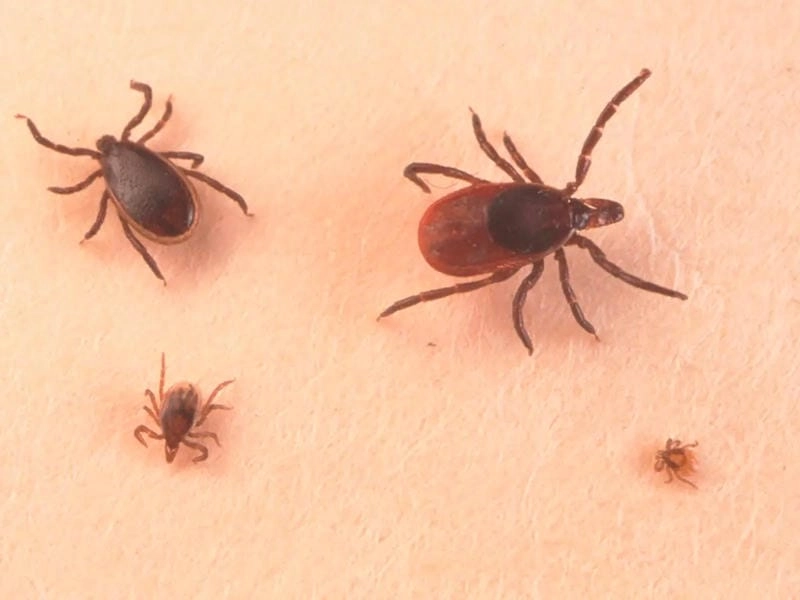 A person showing signs of Colorado tick fever symptoms
