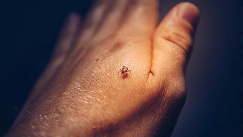 A close-up of a Colorado tick fever rash on skin