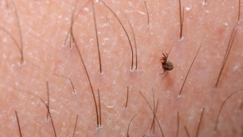 Learn early tick-borne encephalitis symptoms signs