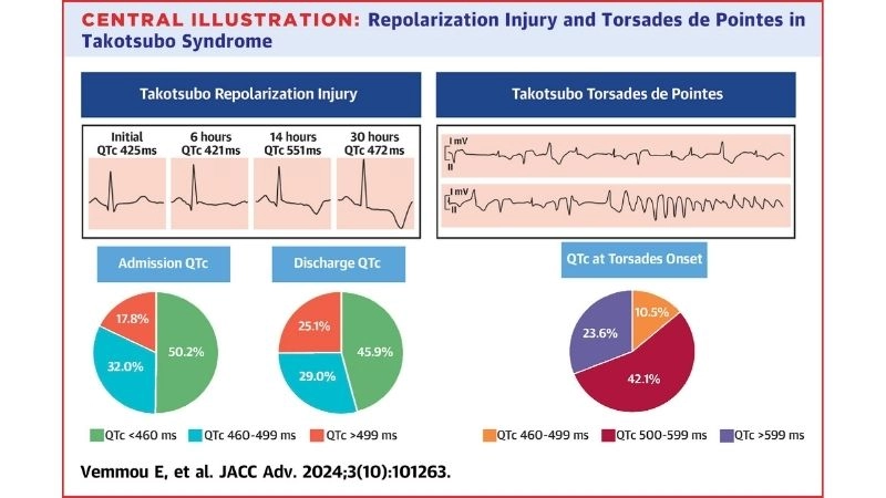 Long QT Syndrome Torsades De Pointes serious complication