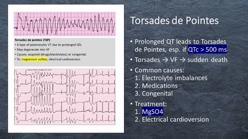 Torsades De Pointes Nursing focuses on monitoring care