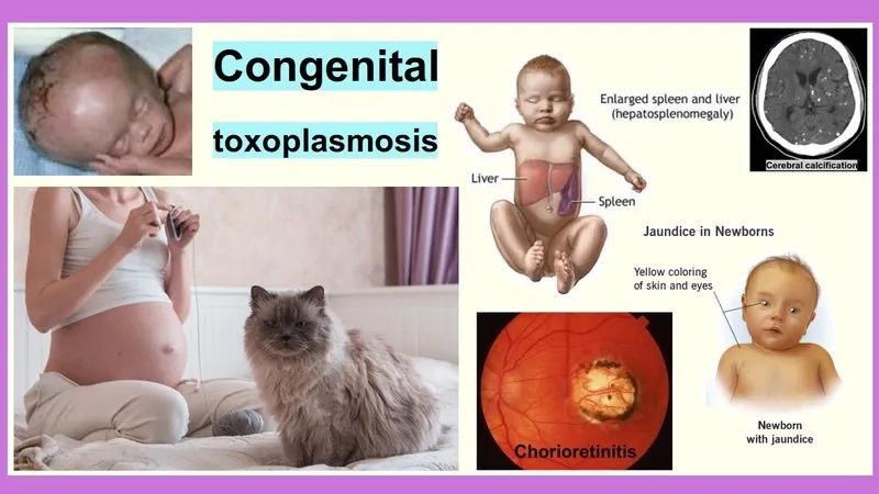 A diagram showing ocular toxoplasmosis (mắt)