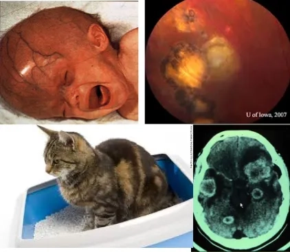 Effective methods for the prevention of toxoplasmosis