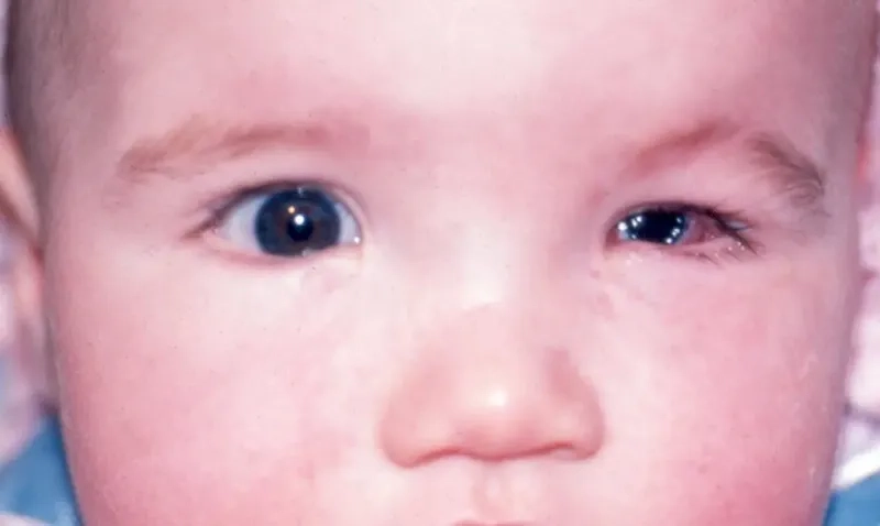 A laboratory professional testing for toxoplasmosis