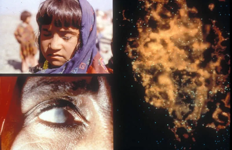 An overview of modern trachoma treatment options