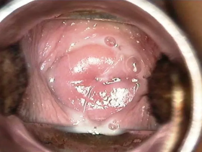 Diagram showing how do you get trichomoniasis