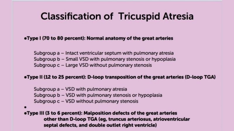 Tricuspid atresia heart defect understanding the condition