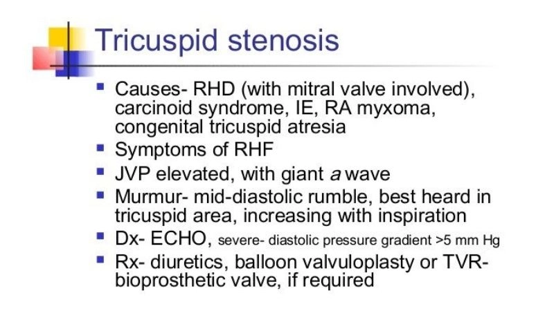 Tricuspid Stenosis In Adults rare but serious condition