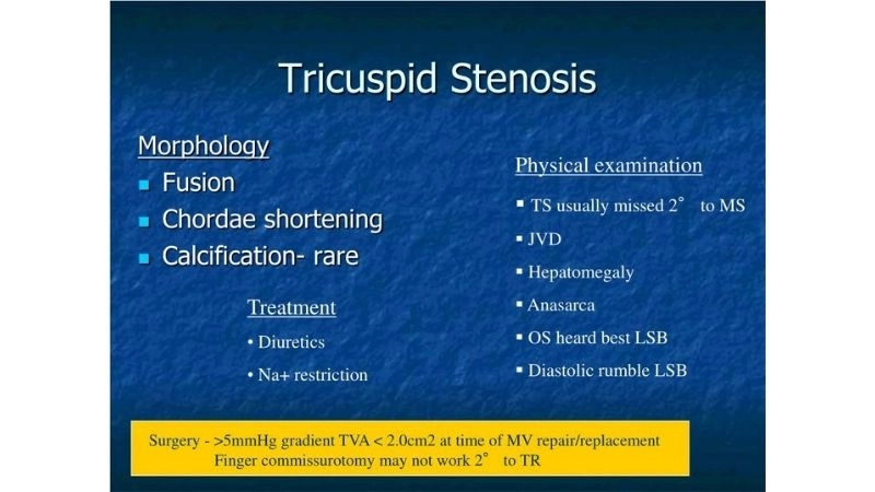 Congenital Tricuspid Stenosis detected from birth