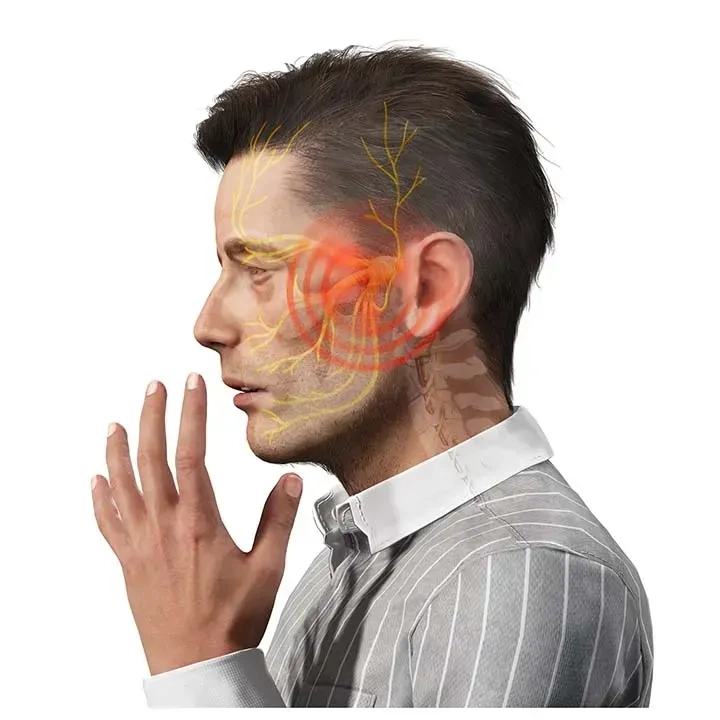 A diagram showing common trigeminal neuralgia symptoms