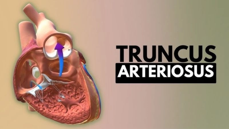 Truncus arteriosus symptoms and early warning signs