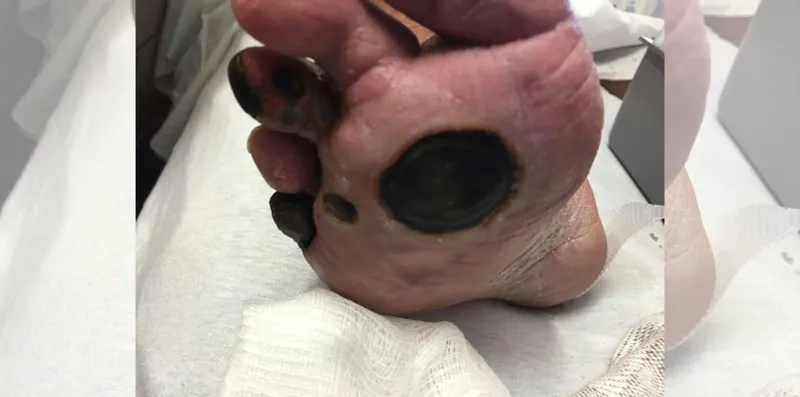 Doctor explaining what is type 2 diabetes