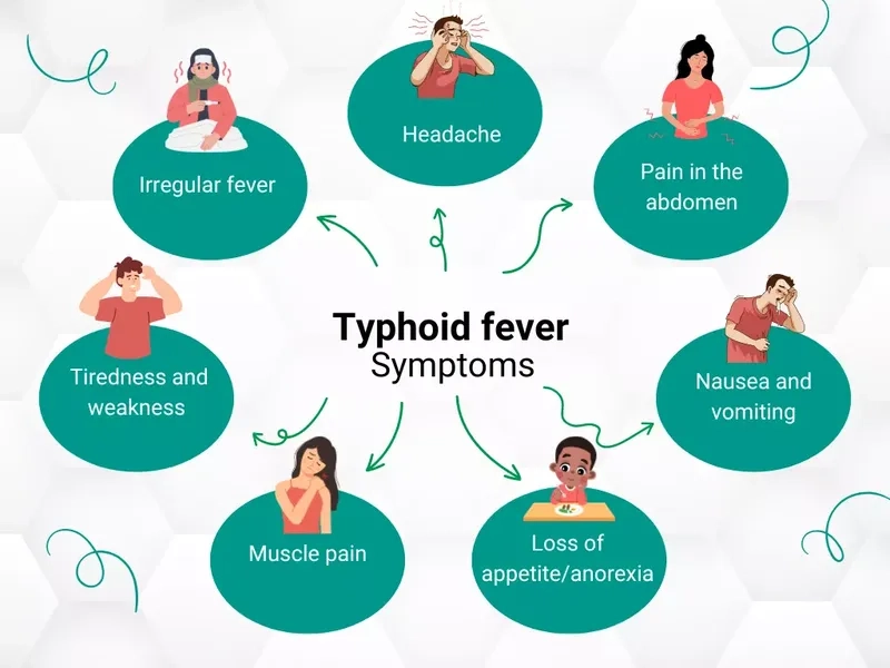 Recognizing the early typhoid fever symptoms