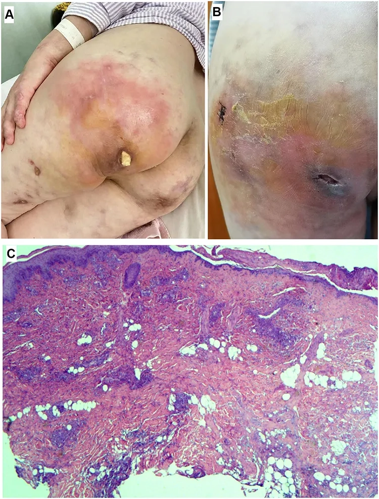 The process of testing for Ureaplasma