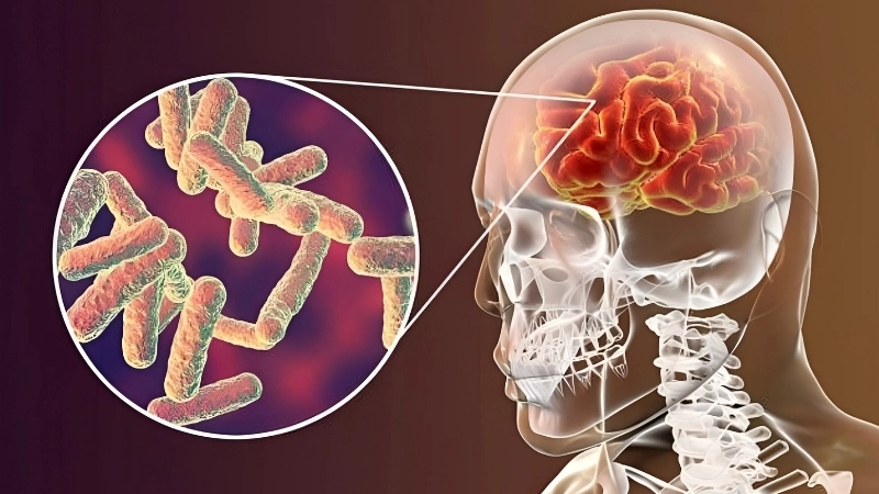 Encephalitis symptoms vary by severity and age