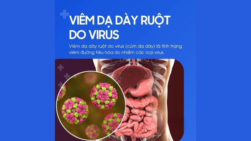 Viral Gastroenteritis diarrhea stomach flu
