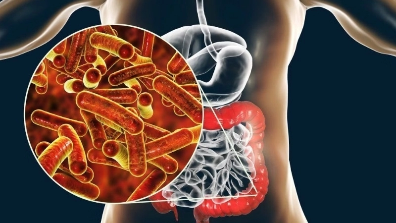 Viral Gastroenteritis nausea stomach flu