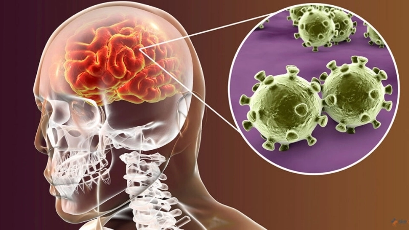 Understand main meningitis causes quickly