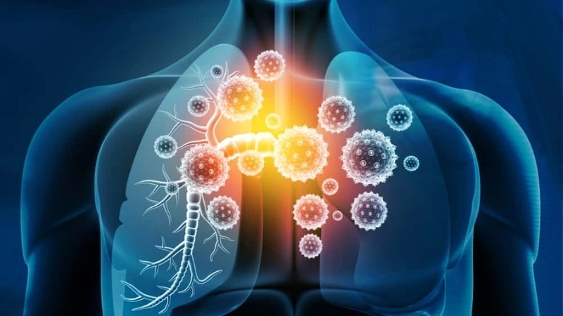 Learn how viral pneumonia contagious spreads quickly