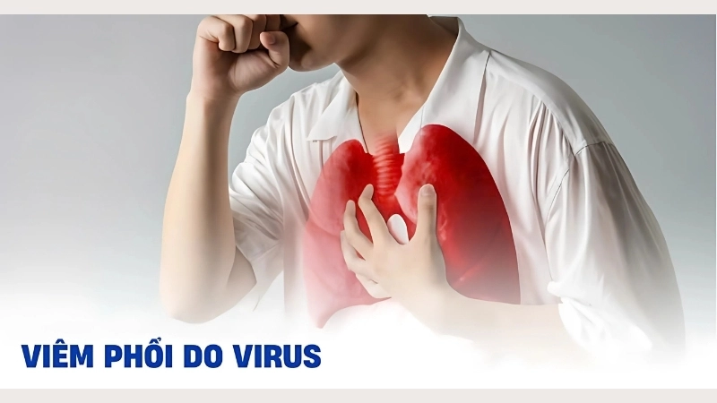 Key symptoms of viral pneumonia to watch for