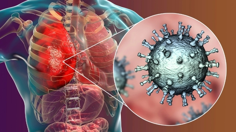 Recognize early viral pneumonia symptoms easily