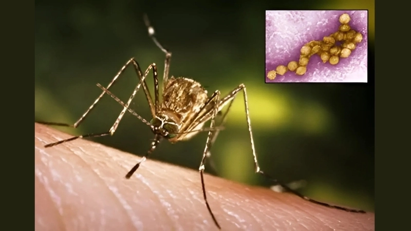 West Nile Virus symptoms include fever fatigue