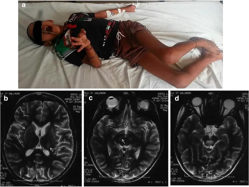 Diagram of a genetic liver disease condition