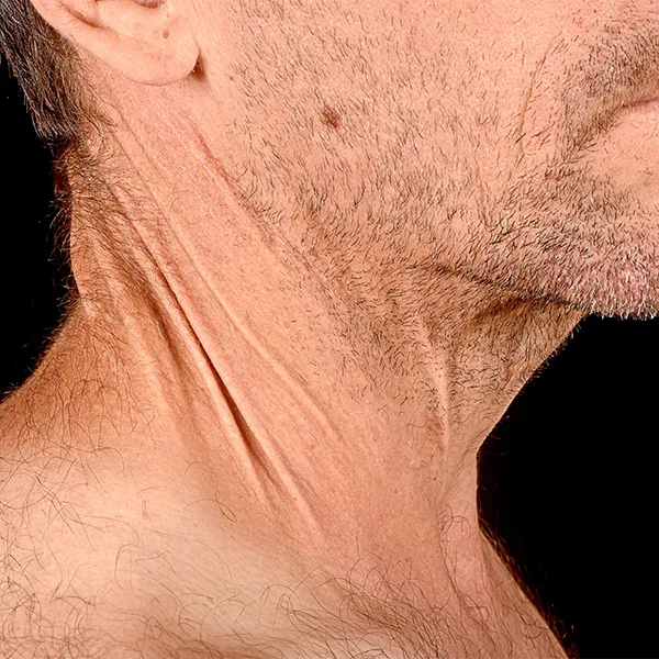 Nutrition plan for a low copper diet