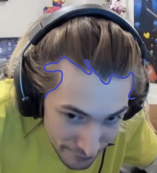 Capturing the xqc malding meme perfectly