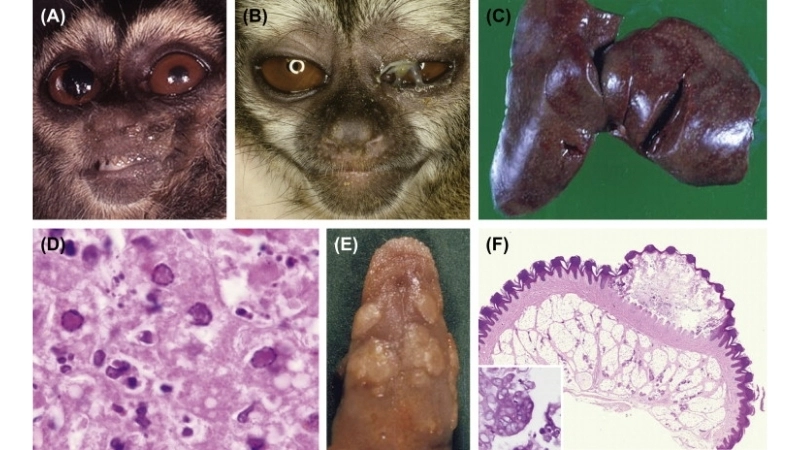 Yaba Monkey Tumor Virus Infection within yatapoxvirus family