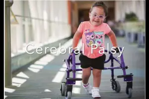 Understanding the causes and complexities of cerebral palsy