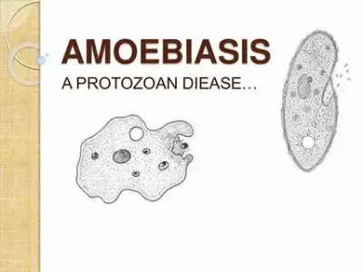 How to effectively treat an amebiasis infection
