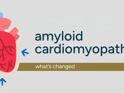 How amyloid cardiomyopathy impacts heart function daily