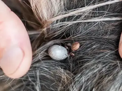 Anaplasmosis - Understanding this tick-borne threat