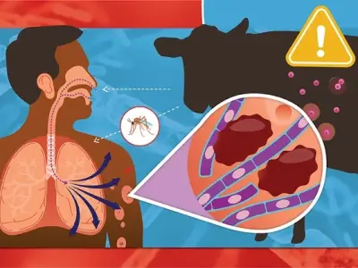 Gastrointestinal anthrax - A rare but deadly disease