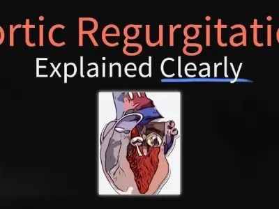 Understanding Aortic Regurgitation (Insufficiency) deeply