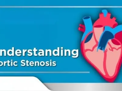Aortic stenosis symptoms and early warning indicators