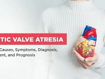 Aortic Valve Atresia risk factors and early detection tips