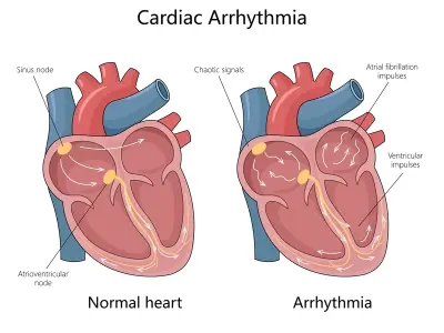 Diagnosing the underlying cause of a cardiac arrhythmia