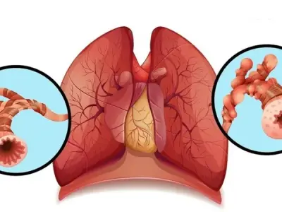 The difference between allergic and non-allergic asthma