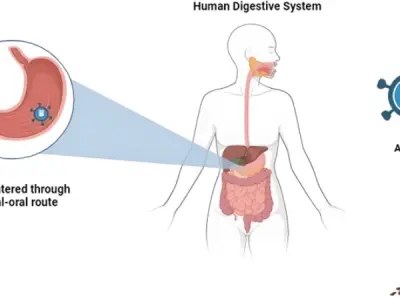 Understanding astrovirus infection symptoms and prevention