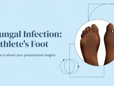 Recognizing the itching and scaling signs of athlete's foot