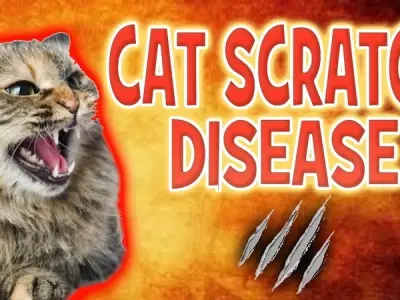 Bartonellosis - Main causes of Bartonellosis?