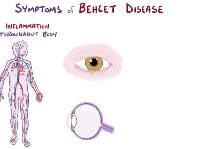 Living a full life with Behçet's disease - A patient's guide