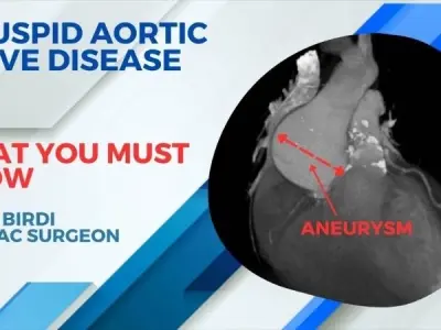What is Bicuspid Aortic Valve Disease and why it matters