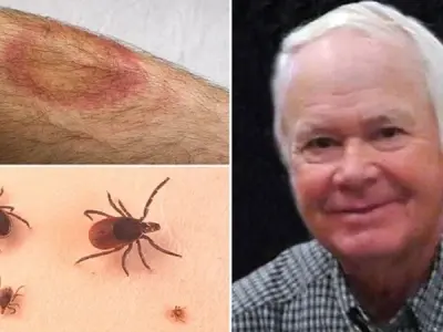 Understanding Bourbon Virus Disease symptoms and risks