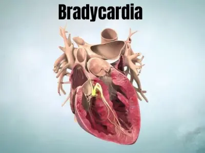 Bradycardia (Sinus Bradycardia) warning signs you must know